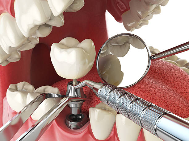 Best Weekend Emergency Dentist in Effort, PA